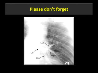 Please don’t forget
63
 