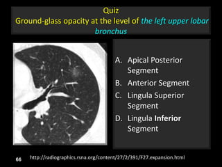 Quiz
Ground-glass opacity at the level of the left upper lobar
bronchus
A. Apical Posterior
Segment
B. Anterior Segment
C. Lingula Superior
Segment
D. Lingula Inferior
Segment
66 http://radiographics.rsna.org/content/27/2/391/F27.expansion.html
 