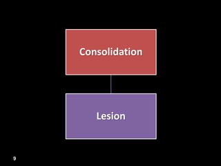 Consolidation
Lesion
9
 