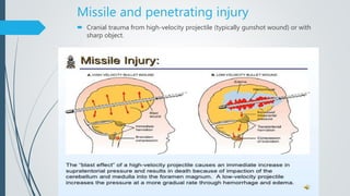 Missile and penetrating injury
 Cranial trauma from high-velocity projectile (typically gunshot wound) or with
sharp object.
 