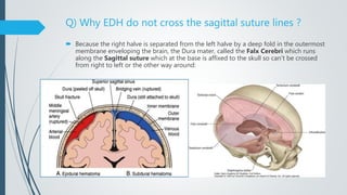 Q) Why EDH do not cross the sagittal suture lines ?
 Because the right halve is separated from the left halve by a deep fold in the outermost
membrane enveloping the brain, the Dura mater, called the Falx Cerebri which runs
along the Sagittal suture which at the base is affixed to the skull so can't be crossed
from right to left or the other way around:
 