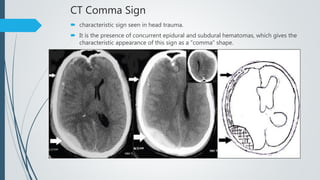 CT Comma Sign
 characteristic sign seen in head trauma.
 It is the presence of concurrent epidural and subdural hematomas, which gives the
characteristic appearance of this sign as a "comma" shape.
 