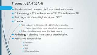 Traumatic SAH (tSAH)
 Blood contained between pia & arachnoid membranes
 Epidemiology – 33% with moderate TBI, 60% with severe TBI.
 Best diagnostic clue – High density on NECT
 Location
Focal –adjacent to contusion, EDH, SDH, fracture, laceration
Sylvian fissure, inferior frontal subarachnoid spaces most common
Diffuse – in subarachnoid space &/or basal cisterns
 Pathology – bleeding from cortical arteries/veins.
 Associated abnormalities
 Contusions
 EDH
 SDH
 Diffuse axonal injury
 