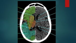 Ct Head Tutorial CT HEAD ANATOMY.pptx (NORMAL ANATOMY OF CT HEAD | PPTX