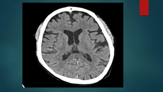 Ct Head Tutorial CT HEAD ANATOMY.pptx (NORMAL ANATOMY OF CT HEAD | PPTX