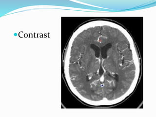 Ct head made easy | PPTX