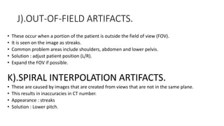 J).OUT-OF-FIELD ARTIFACTS.
• These occur when a portion of the patient is outside the field of view (FOV).
• It is seen on the image as streaks.
• Common problem areas include shoulders, abdomen and lower pelvis.
• Solution : adjust patient position (L/R).
• Expand the FOV if possible.
K).SPIRAL INTERPOLATION ARTIFACTS.
• These are caused by images that are created from views that are not in the same plane.
• This results in inaccuracies in CT number.
• Appearance : streaks
• Solution : Lower pitch.
 