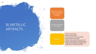 B).METALLIC
ARTIFACTS.
Highly dense objects in
and around patient can
cause significant
streaking.
Appearance; Streaking
on the image.
• Remove metal objects.
• Decrease section width.
• Increase kVp for better penetrability.
• Adjust window level settings.
• Reorient data acquisition (e.g. gantry tilt)
• Metallic Artifact Reduction (MAR) software.
MAR uses interpolation to substitute over
range values in attenuation profiles.
Solutions:
 