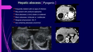 Ct Imaging of Abdomen Dr. Muhammad Bin Zulfiqar | PPTX