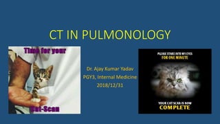 CT IN PULMONOLOGY
Dr. Ajay Kumar Yadav
PGY3, Internal Medicine
2018/12/31
 