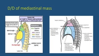 D/D of mediastinal mass
 