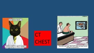 CT
CHEST
 