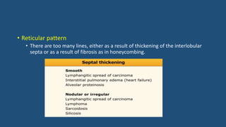 • Reticular pattern
• There are too many lines, either as a result of thickening of the interlobular
septa or as a result of fibrosis as in honeycombing.
 