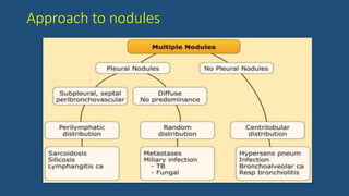 Approach to nodules
 