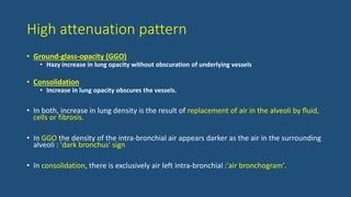 High attenuation pattern
• Ground-glass-opacity (GGO)
• Hazy increase in lung opacity without obscuration of underlying vessels
• Consolidation
• Increase in lung opacity obscures the vessels.
• In both, increase in lung density is the result of replacement of air in the alveoli by fluid,
cells or fibrosis.
• In GGO the density of the intra-bronchial air appears darker as the air in the surrounding
alveoli : 'dark bronchus' sign
• In consolidation, there is exclusively air left intra-bronchial :'air bronchogram'.
 