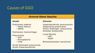 Causes of GGO
 