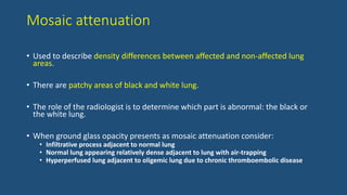 Mosaic attenuation
• Used to describe density differences between affected and non-affected lung
areas.
• There are patchy areas of black and white lung.
• The role of the radiologist is to determine which part is abnormal: the black or
the white lung.
• When ground glass opacity presents as mosaic attenuation consider:
• Infiltrative process adjacent to normal lung
• Normal lung appearing relatively dense adjacent to lung with air-trapping
• Hyperperfused lung adjacent to oligemic lung due to chronic thromboembolic disease
 
