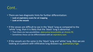 Cont..
• There are two diagnostic hints for further differentiation:
• Look at expiratory scans for air trapping
• Look at the vessels
• If the vesses are difficult to see in the 'black' lung as compared to the
'white' lung, than it is likely that the 'black' lung is abnormal.
• Then there are two possibilities: obstructive bronchiolitis or chronic PE.
• Sometimes these can be differentiated with an expiratory scan.
• If the vessels are the same in the 'black' lung and 'white' lung, then we are
looking at a patient with infiltrative lung disease e.g. pulmonary h’ge.
 