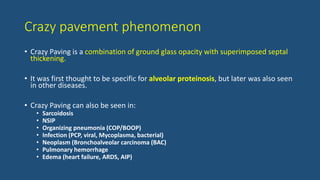 Crazy pavement phenomenon
• Crazy Paving is a combination of ground glass opacity with superimposed septal
thickening.
• It was first thought to be specific for alveolar proteinosis, but later was also seen
in other diseases.
• Crazy Paving can also be seen in:
• Sarcoidosis
• NSIP
• Organizing pneumonia (COP/BOOP)
• Infection (PCP, viral, Mycoplasma, bacterial)
• Neoplasm (Bronchoalveolar carcinoma (BAC)
• Pulmonary hemorrhage
• Edema (heart failure, ARDS, AIP)
 