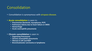 Consolidation
• Consolidation is synonymous with airspace disease.
• Acute consolidation is seen in:
• Pneumonias (bacterial, mycoplasma, PCP)
• Pulmonary edema due to heart failure or ARDS
• Hemorrhage
• Acute eosinophilic pneumonia
• Chronic consolidation is seen in:
• Organizing Pneumonia
• Chronic eosinophilic pneumonia
• Fibrosis in UIP and NSIP
• Bronchoalveolar carcinoma or lymphoma
 
