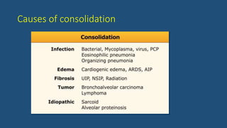 Causes of consolidation
 