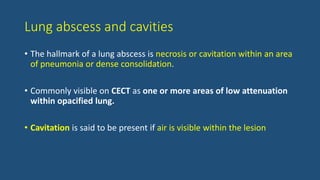 Lung abscess and cavities
• The hallmark of a lung abscess is necrosis or cavitation within an area
of pneumonia or dense consolidation.
• Commonly visible on CECT as one or more areas of low attenuation
within opacified lung.
• Cavitation is said to be present if air is visible within the lesion
 