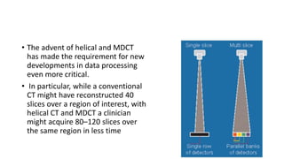 • The advent of helical and MDCT
has made the requirement for new
developments in data processing
even more critical.
• In particular, while a conventional
CT might have reconstructed 40
slices over a region of interest, with
helical CT and MDCT a clinician
might acquire 80–120 slices over
the same region in less time
 