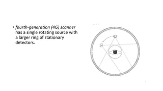 • fourth-generation (4G) scanner
has a single rotating source with
a larger ring of stationary
detectors.
 