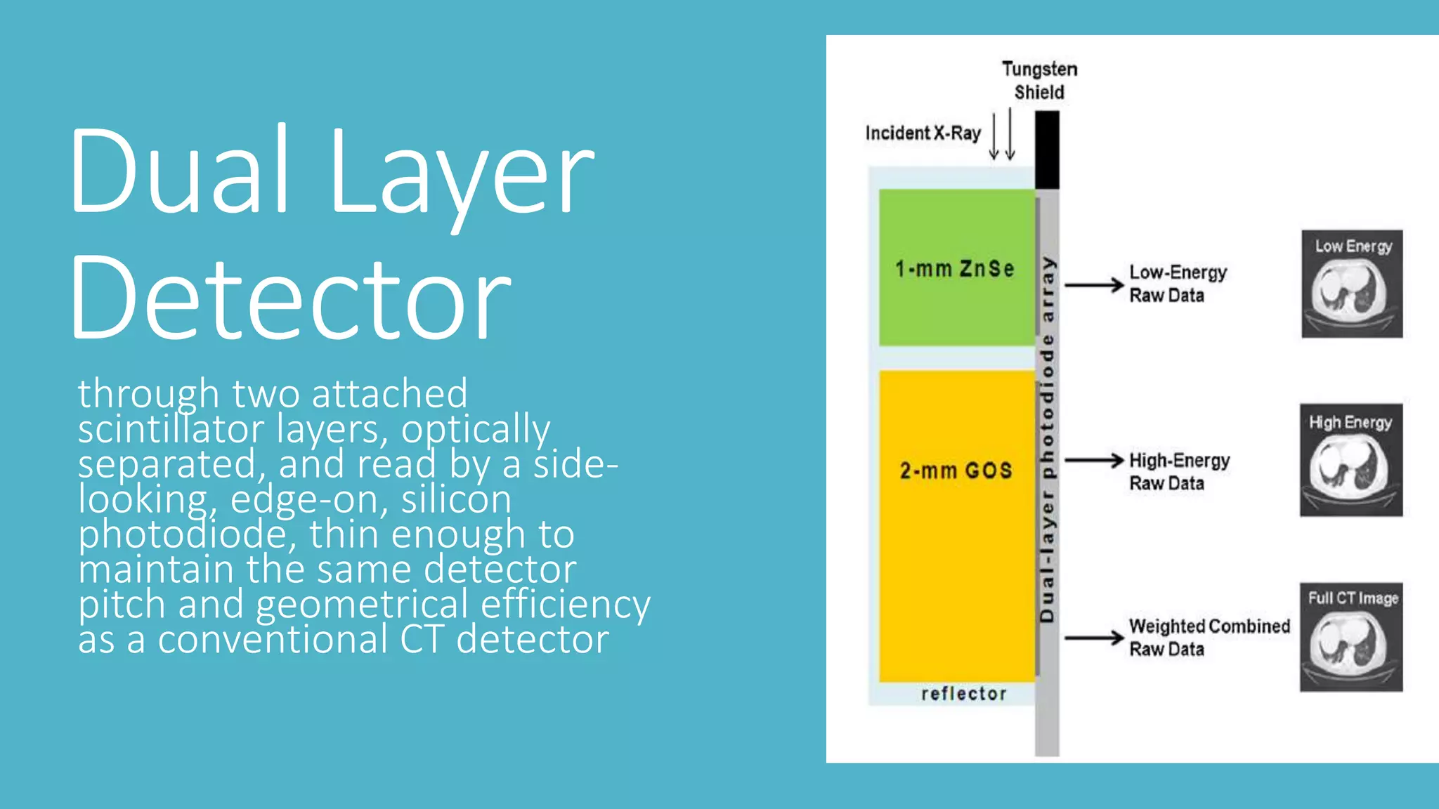 Dual Layer
Detector
through two attached
scintillator layers, optically
separated, and read by a side-
looking, edge-on, silicon
photodiode, thin enough to
maintain the same detector
pitch and geometrical efficiency
as a conventional CT detector
 