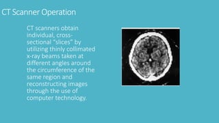 CT Scanner Operation
CT scanners obtain
individual, cross-
sectional “slices” by
utilizing thinly collimated
x-ray beams taken at
different angles around
the circumference of the
same region and
reconstructing images
through the use of
computer technology.
 