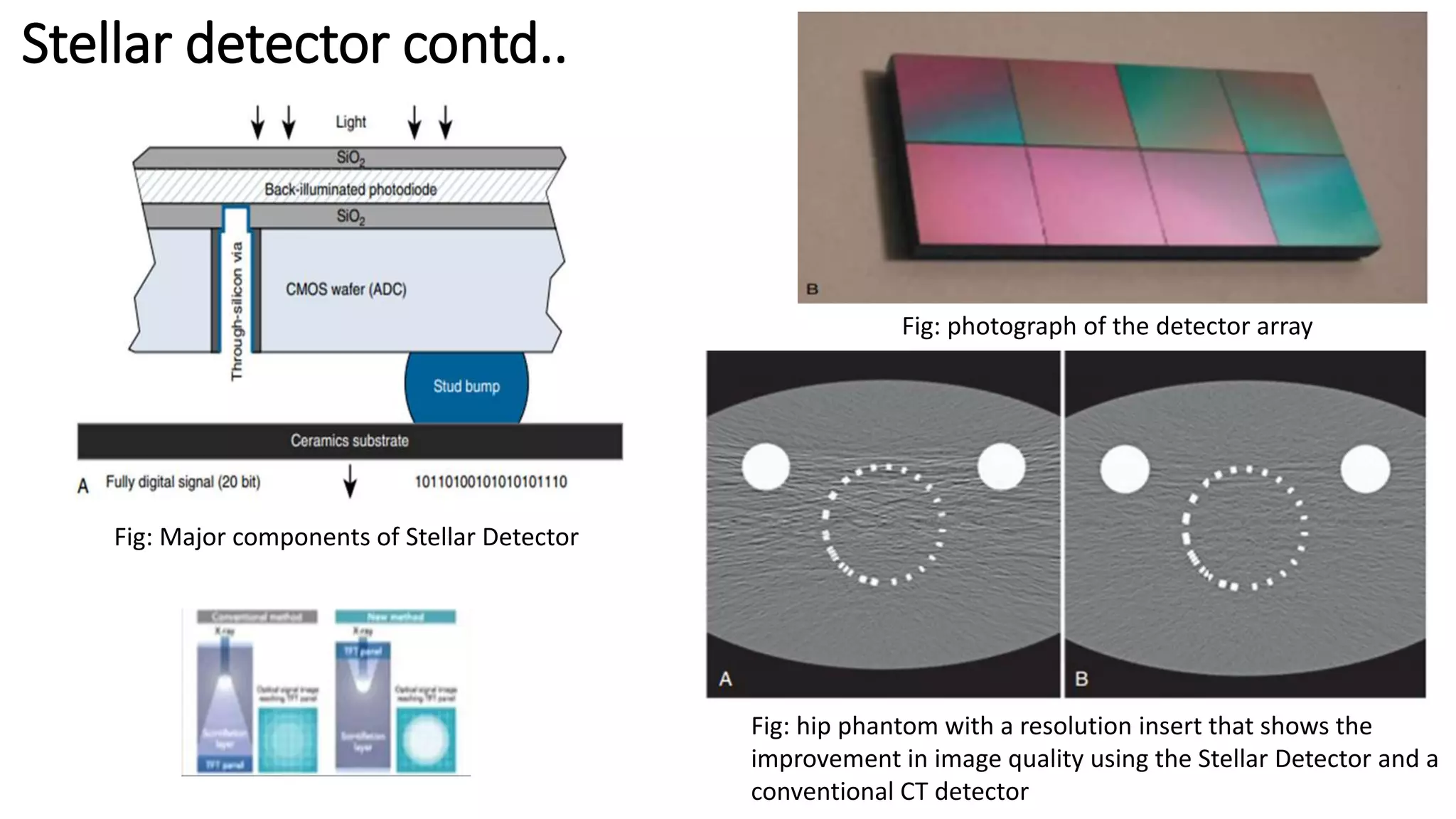 Stellar detector contd..
Fig: Major components of Stellar Detector
Fig: photograph of the detector array
Fig: hip phantom with a resolution insert that shows the
improvement in image quality using the Stellar Detector and a
conventional CT detector
 