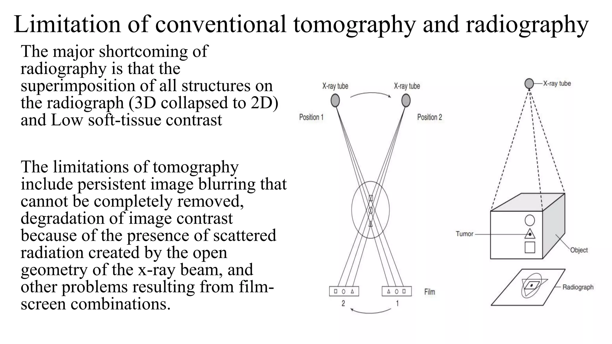 Limitation of conventional tomography and radiography
The major shortcoming of
radiography is that the
superimposition of all structures on
the radiograph (3D collapsed to 2D)
and Low soft-tissue contrast
The limitations of tomography
include persistent image blurring that
cannot be completely removed,
degradation of image contrast
because of the presence of scattered
radiation created by the open
geometry of the x-ray beam, and
other problems resulting from film-
screen combinations.
 