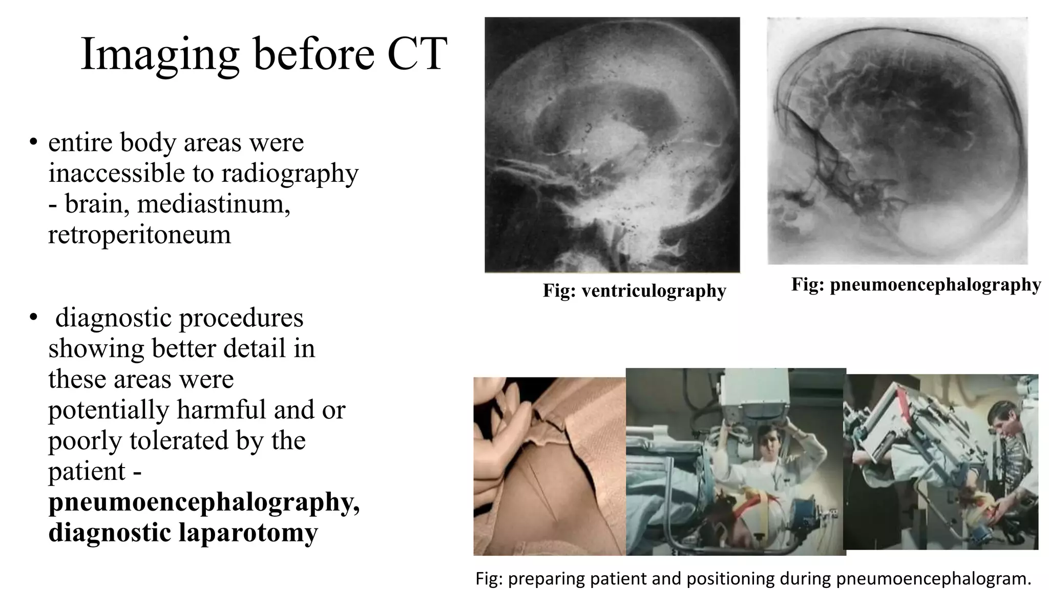 Imaging before CT
• entire body areas were
inaccessible to radiography
- brain, mediastinum,
retroperitoneum
• diagnostic procedures
showing better detail in
these areas were
potentially harmful and or
poorly tolerated by the
patient -
pneumoencephalography,
diagnostic laparotomy
Fig: ventriculography Fig: pneumoencephalography
Fig: preparing patient and positioning during pneumoencephalogram.
 