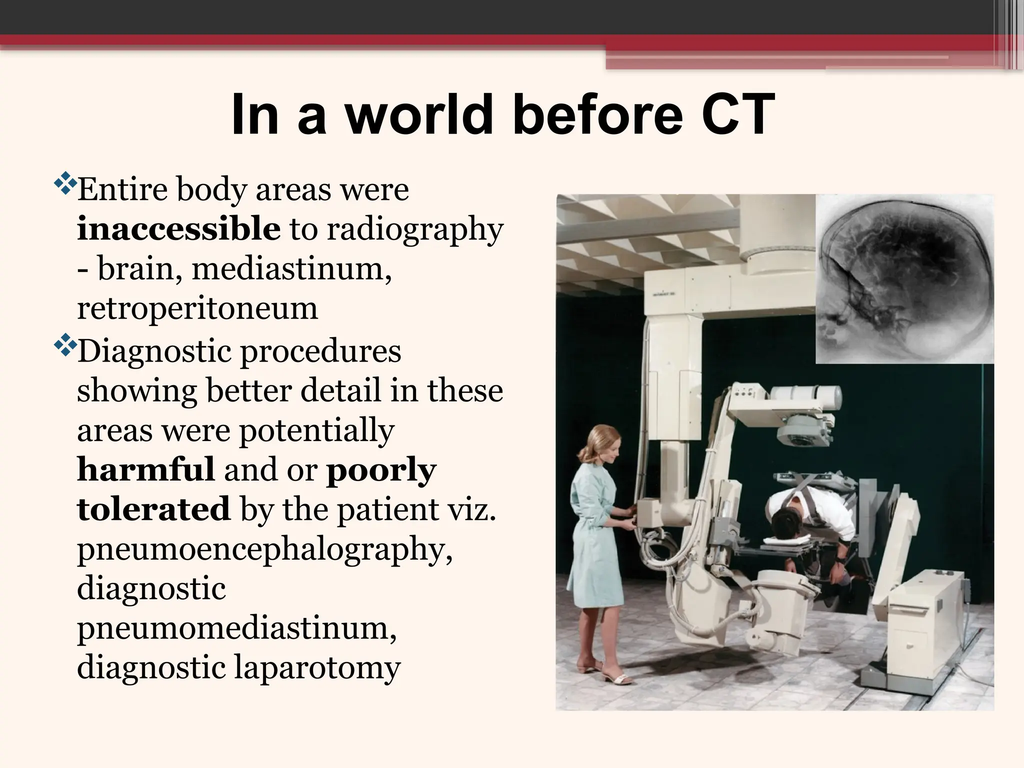 In a world before CT
Entire body areas were
inaccessible to radiography
- brain, mediastinum,
retroperitoneum
Diagnostic procedures
showing better detail in these
areas were potentially
harmful and or poorly
tolerated by the patient viz.
pneumoencephalography,
diagnostic
pneumomediastinum,
diagnostic laparotomy
 