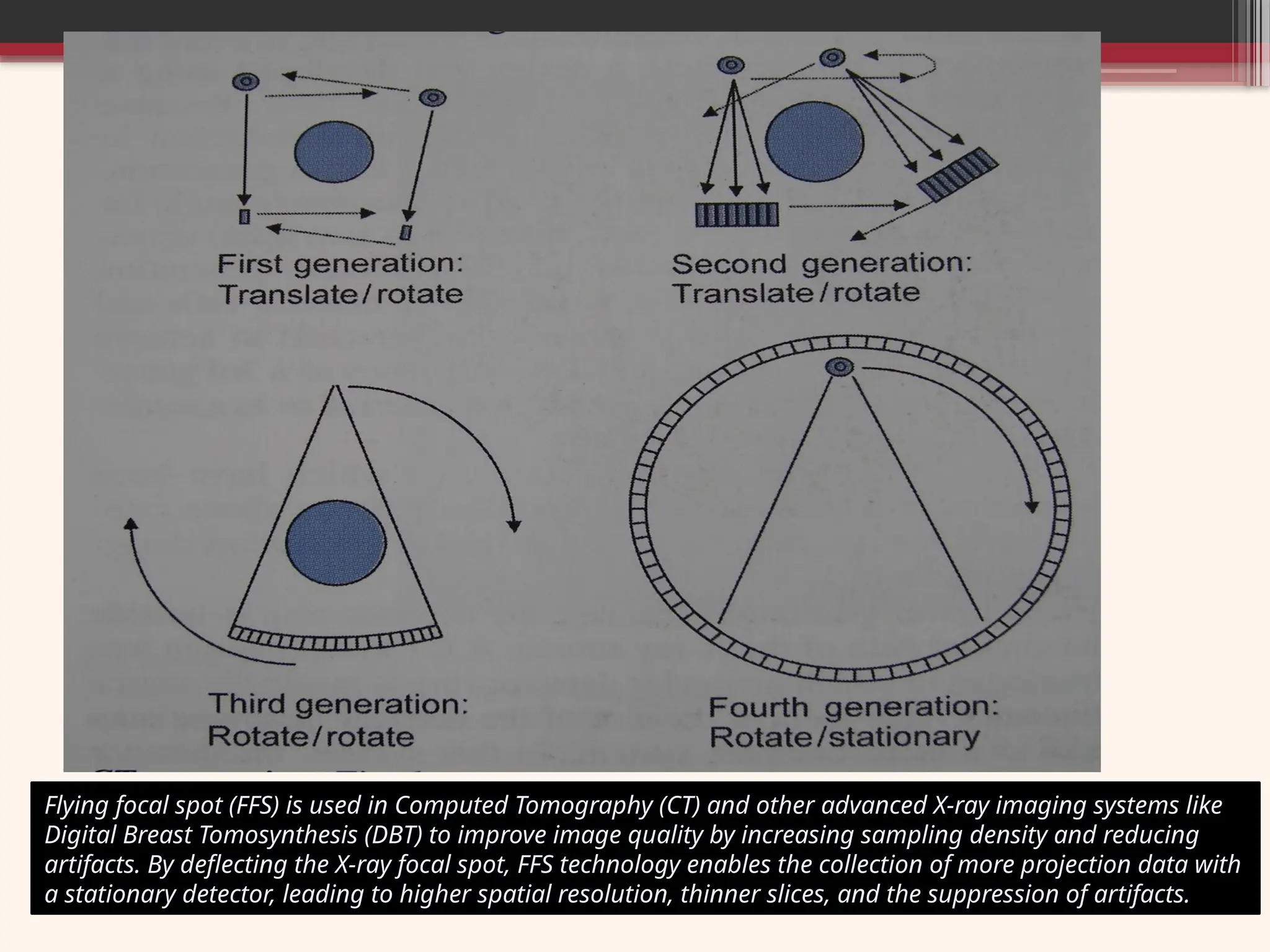 Flying focal spot (FFS) is used in Computed Tomography (CT) and other advanced X-ray imaging systems like
Digital Breast Tomosynthesis (DBT) to improve image quality by increasing sampling density and reducing
artifacts. By deflecting the X-ray focal spot, FFS technology enables the collection of more projection data with
a stationary detector, leading to higher spatial resolution, thinner slices, and the suppression of artifacts.
 