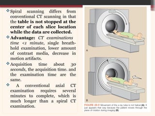 Computed Tomography: Hardware and Instrumentation | PPTX