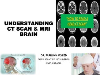 UNDERSTANDING
CT SCAN & MRI
BRAIN
DR. FARRUKH JAVEED
CONSULTANT NEUROSURGEON
JPMC, KARACHI.
 