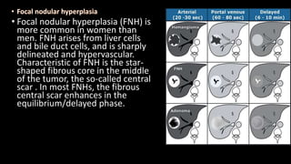 • Focal nodular hyperplasia (FNH) is
more common in women than
men. FNH arises from liver cells
and bile duct cells, and is sharply
delineated and hypervascular.
Characteristic of FNH is the star-
shaped fibrous core in the middle
of the tumor, the so-called central
scar . In most FNHs, the fibrous
central scar enhances in the
equilibrium/delayed phase.
 