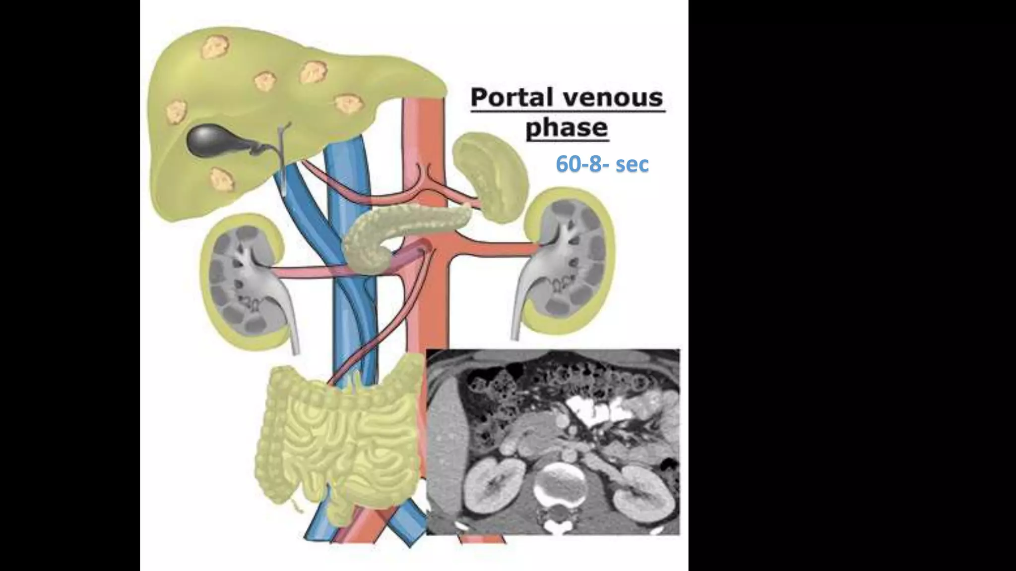 Liver segments Radiopaedia.com1