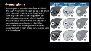 • Hemangiomas are common abnormalities in
the liver. A hemangioma can be up to 10 cm in
size. Hemangiomas are sharply delineated
with a specific enhancement pattern. The
arterial phase reveals peripheral, nodular,
discontinuous enhancement and the portal
venous phase reveals progressive filling.
Characteristic of hemangiomas is that the
enhancement in each phase corresponds with
the ‘blood pool’
 