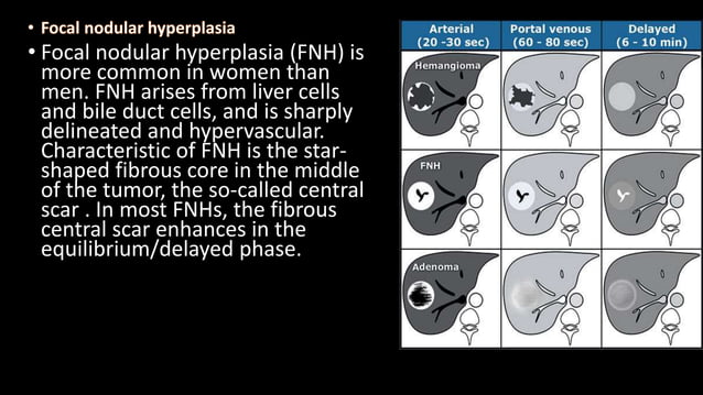 Liver segments Radiopaedia.com1