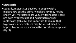 •Metastasis
•Logically, metastases develop in people with a
malignancy, but the primary malignancy may not be
known yet. Metastases are vaguely delineated. There
are both hypovascular and hypervascular liver
metastases (table 6). It is important to realize that
hypervascular metastases may be very difficult or
impossible to see on a scan in the portal venous phase
(fig. 9).
 