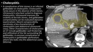 • Cholecystitis
• A complication of bile stones is an infected
gallbladder or cholecystitis. Cholecystitis
rarely occurs in the absence of bile stones.
Ultrasound is also best suited to diagnose
cholecystitis. Ultrasound improves the
visibility of the bile stones, and gallbladder
compressibility can be evaluated (dynamic
examination). Absent compressibility
constitutes a key characteristic of
cholecystitis (see abdominal ultrasound
class). Other characteristics of cholecystitis
on CT include gallbladder wall thickening
and infiltration of the fat surrounding the
gallbladder. A common complication of
cholecystitis is gallbladder perforation,
where bile leaks into the abdominal cavity
(biloma).
 