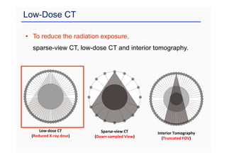 Low-Dose CT
• To reduce the radiation exposure,
sparse-view CT, low-dose CT and interior tomography.
Sparse-view CT
(Down-sampled View)
Low-dose CT
(Reduced X-ray dose)
Interior Tomography
(Truncated FOV)
 
