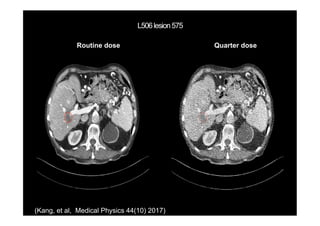 Routine dose Quarter dose
(Kang, et al, Medical Physics 44(10) 2017)
 