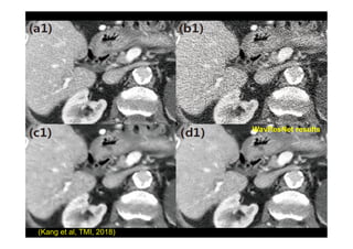 WavResNet results
(Kang et al, TMI, 2018)
 