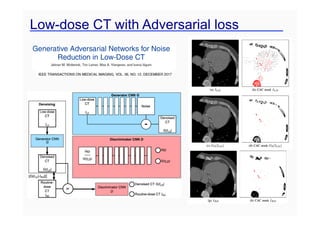 Low-dose CT with Adversarial loss
 