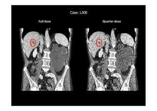 Full dose Quarter dose
 