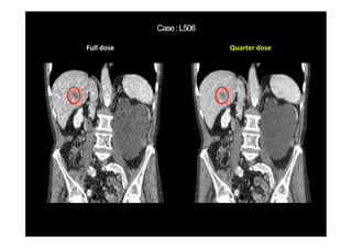 Full dose Quarter dose
 