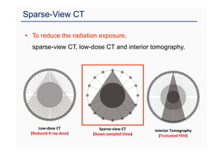 Sparse-View CT
• To reduce the radiation exposure,
sparse-view CT, low-dose CT and interior tomography.
Sparse-view CT
(Down-sampled View)
Low-dose CT
(Reduced X-ray dose)
Interior Tomography
(Truncated FOV)
 